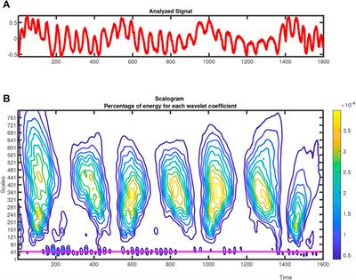 Handling Radar Cross-Section Performance in Monitoring Vital Signs Under Constraint Conditions